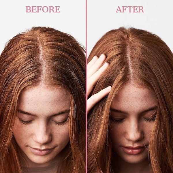 Міні-набір проти лупи та лущення Umberto Giannini Scalp Restore 0058 фото